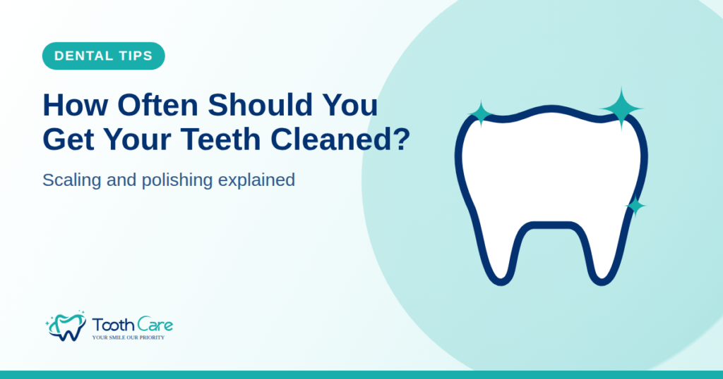 How Often Should You Get Your Teeth Cleaned? scaling and polishing explained (Tooth Care dental tips)