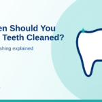How Often Should You Get Your Teeth Cleaned? scaling and polishing explained (Tooth Care dental tips)
